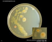 mueller hinton agar with variovorax paradoxus